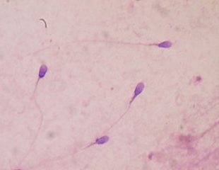 spermatozoides au microscope