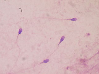 spermatozoides au microscope